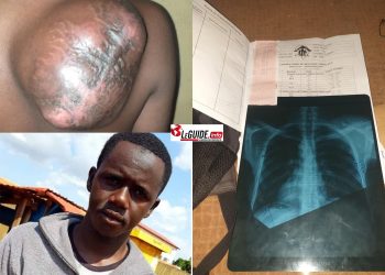 Santé : Aidons Amadou Diallo, sauvons une vie