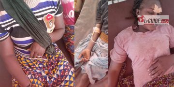 Kobadah sur la route de Bamako : 17 blessés dans un accident de circulation 
