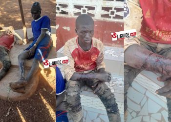 Attaque à main armée à Siguiri : deux jeune orpailleurs blessés par balles dont un burkinabè