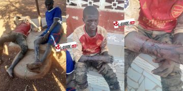 Attaque à main armée à Siguiri : deux jeune orpailleurs blessés par balles dont un burkinabè