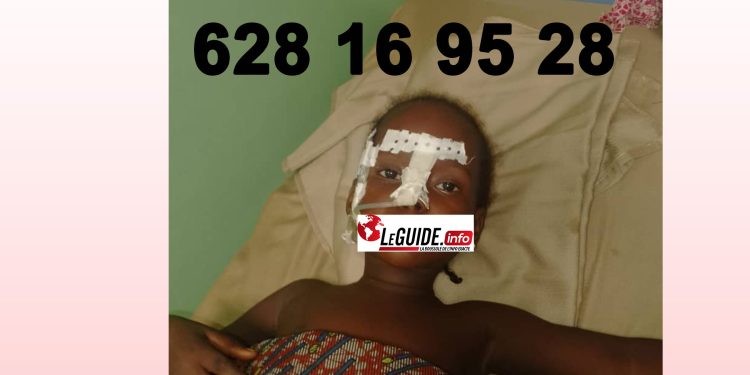 Diaraye Diallo 4 ans, a bu de la soude caustique : ses parents appellent à l’aide 1 Diaraye Diallo 4 ans, a bu de la soude caustique : ses parents appellent à l’aide