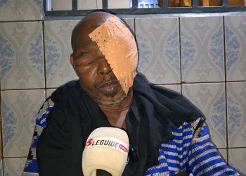 Santé : sauvons ce photographe, il a perdu l’œil gauche 623 16 63 56