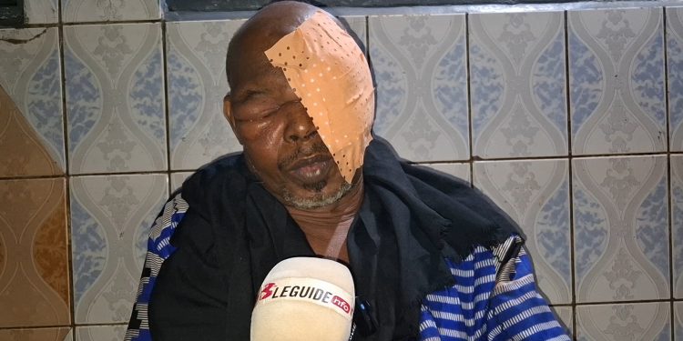 Santé : sauvons ce photographe, il a perdu l’œil gauche 623 16 63 56