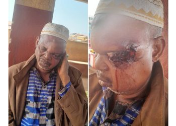 Urgent : sauvons l’œil du photographe Madiou Z (famille)