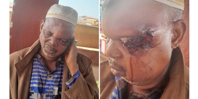 Urgent : sauvons l’œil du photographe Madiou Z (famille) 1 Urgent : sauvons l’œil du photographe Madiou Z (famille)