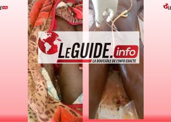 Siguiri : Un jeune homme décide de couper ses bijoux de famille